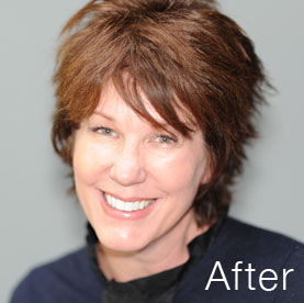 Actual patient after treatment