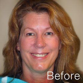 Actual patient before treatment
