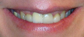 Actual patient before treatment