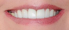 Actual patient after treatment