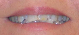 Actual patient before treatment