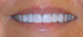 Actual patient after treatment
