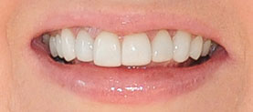 Actual patient after treatment
