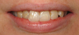 Actual patient before treatment