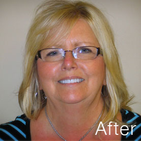 Actual patient after treatment