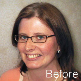 Actual patient before treatment